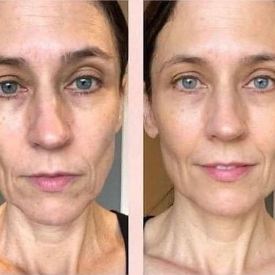 FaceGlow Pro™ Recupera la firmeza y la confianza en solo minutos al día desde Casa