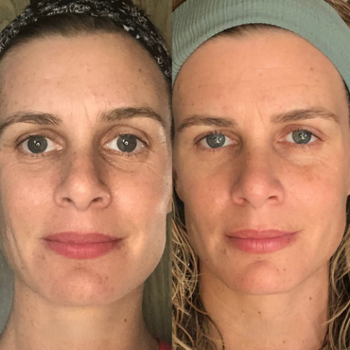 FaceGlow Pro™ Recupera la firmeza y la confianza en solo minutos al día desde Casa